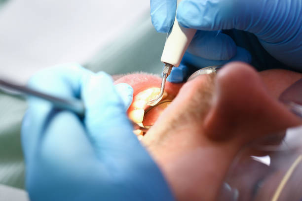 Best Emergency Dental Care for Broken or Chipped Teeth in Taylor Lake Village, TX