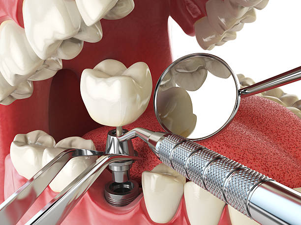Best Emergency TMJ Treatment in Taylor Lake Village, TX