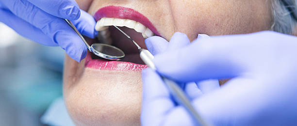 Best Emergency Root Canal Treatment in Taylor Lake Village, TX